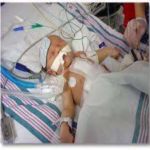 Picc line by abdul fatah