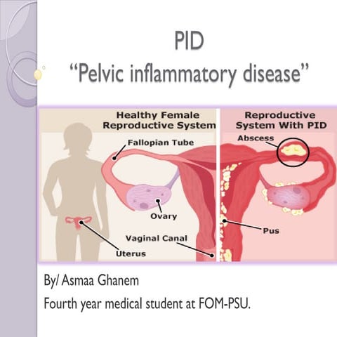 PID 