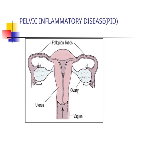 Pelvic inflammatory diseases PowerPoint.ppt