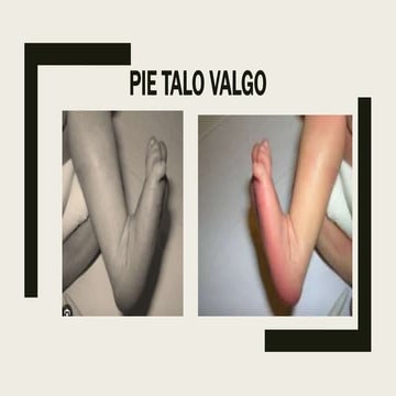 PIE CONGENITO.pptx