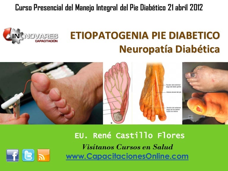 ulceras en los pies por diabetes fotos de flores