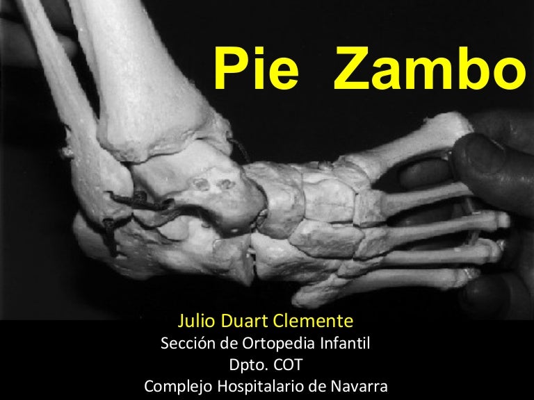 Pie zambo