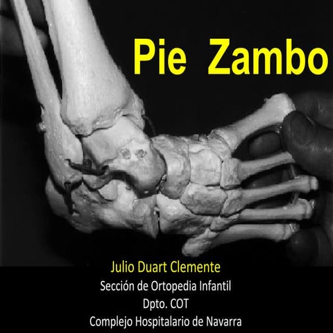 Pie zambo | PPT