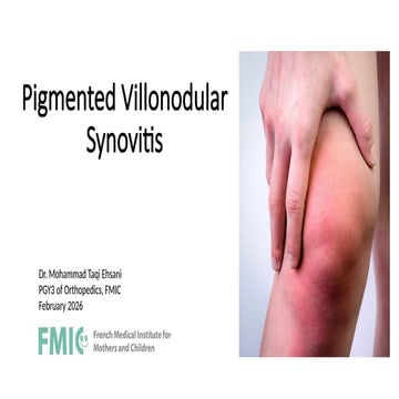 Pigmented Villonodular Synovitis (PVNS).pptx