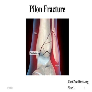 Tibia and fibula diaphysis, ankle and foot injuries | PPTX