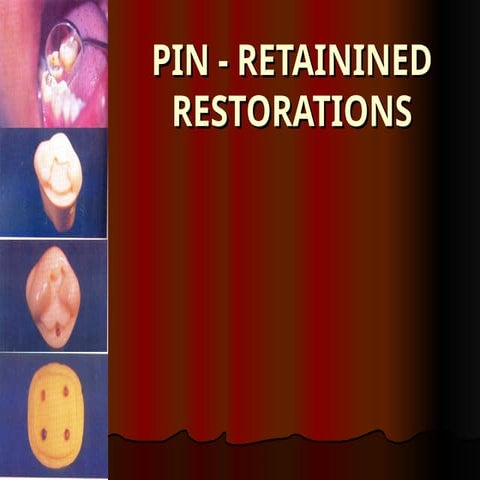 Dentin pins | PPT