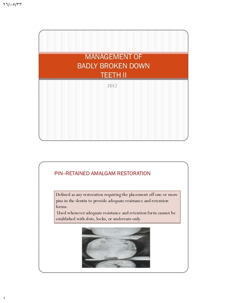 Pin retained amalgam restorations