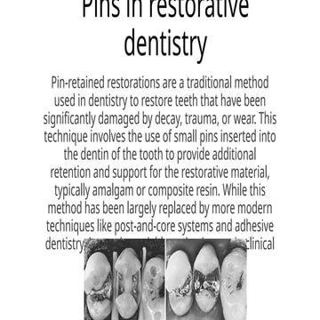 Pin retained restorations | PPTX