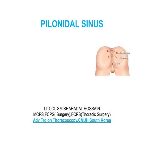 Histopathology of Pilonidal Sinus | PPTX