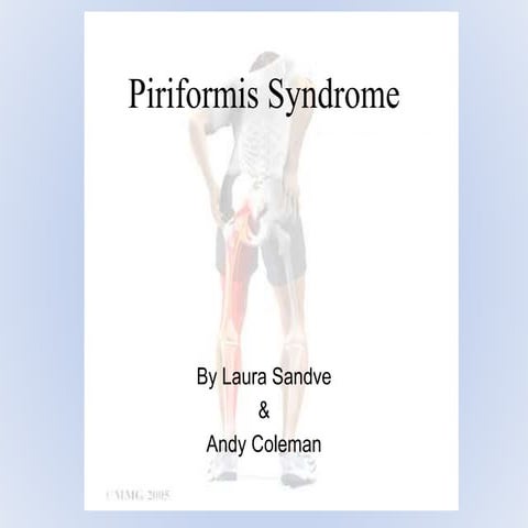 Piriformis syndrome