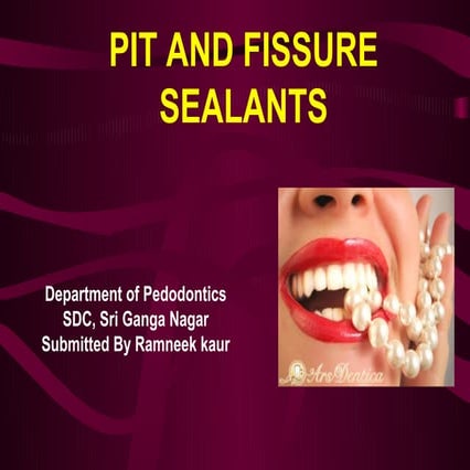 Pit and fissure sealants