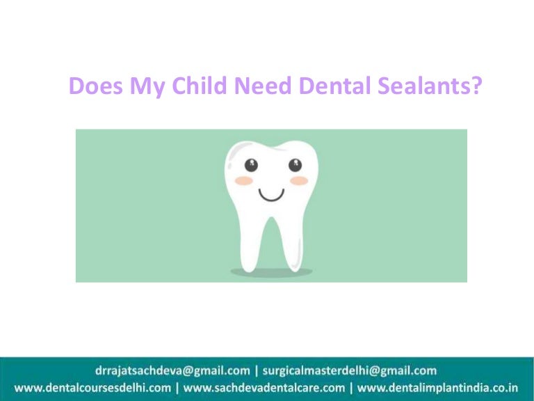 Pit and fissure sealants Pediatric dentistry Dental Vaccination