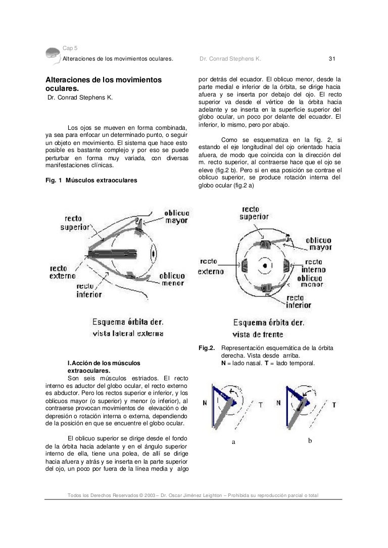 las cadenas oculares causan las cadenas oculares causan