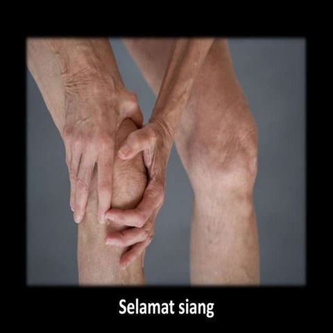 Seminar Awam: Rehabilitasi Medik pada Osteoarthritis Genu 
