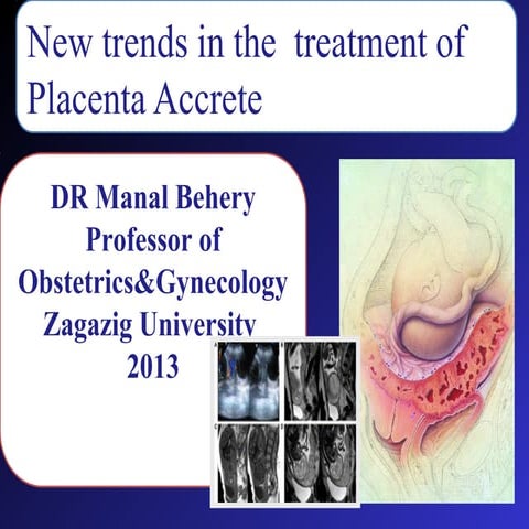 Placenta accreta for post graduate