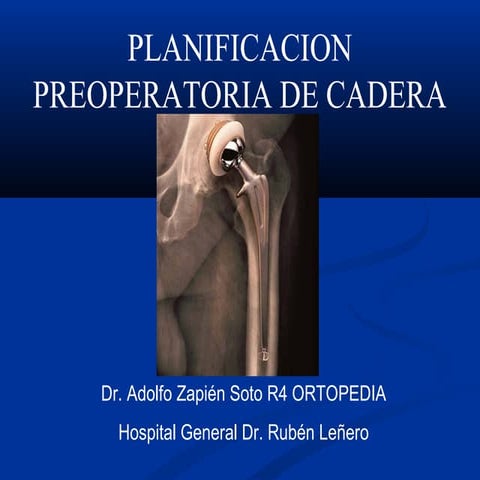 Planificacion preoperatoria de cadera