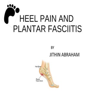 Heel Pain and Plantar Fasciitis