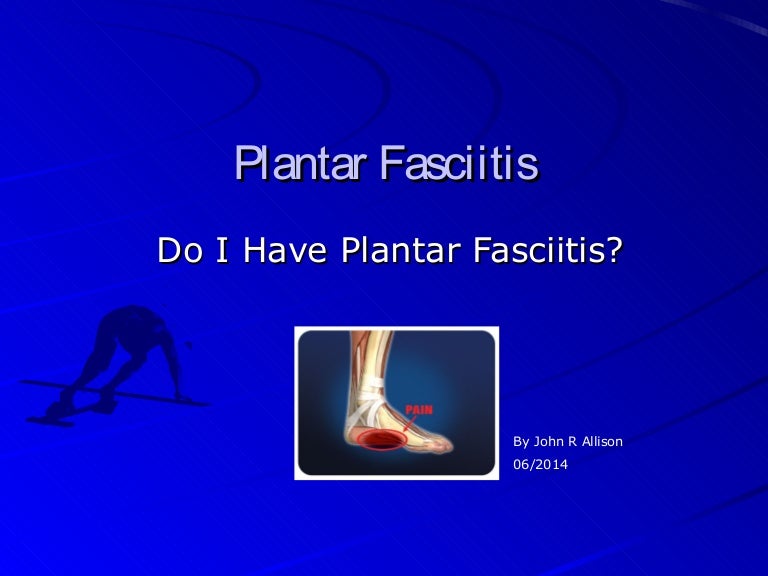 Do I Have Plantar fasciitis?