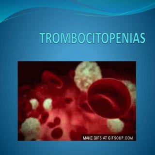 Plaquetas y purpuras trombocitopenicas