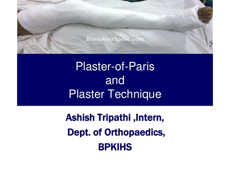 Plaster of Paris and Plaster Technique