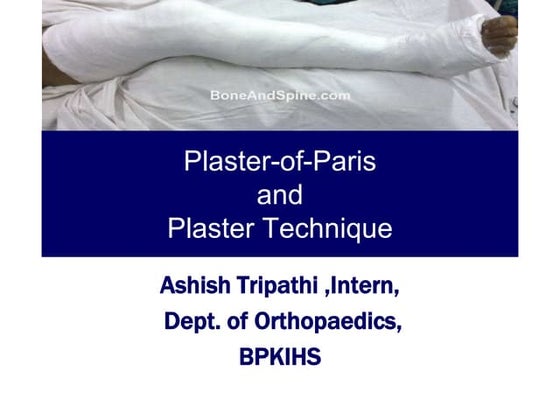 Principles of use of plaster of paris | PPT