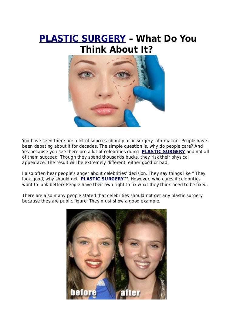 PLASTIC SURGERY What Do You Think About It
