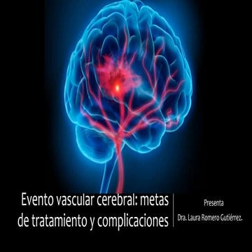 Evento Vascular Cerebral. | PPT