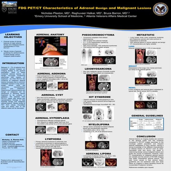 Radiological Imaging of the adrenal masses | PPTX