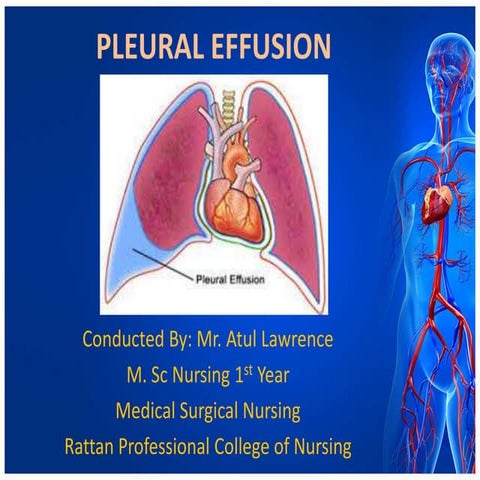 Pleural Effusion