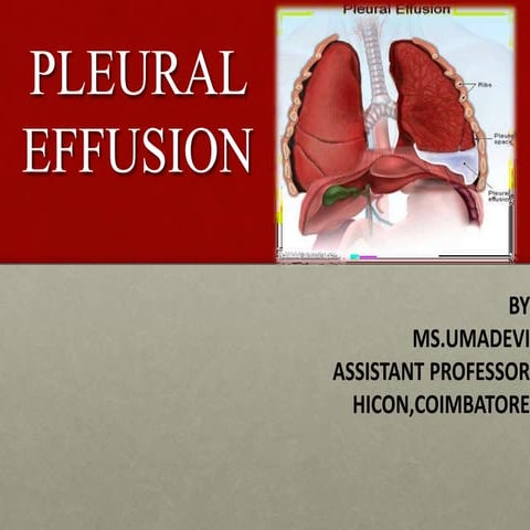 pleuraleffusion.pptx