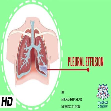 Pleural effusion & empyema.pptx