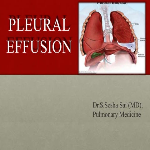 Lights criteria pleural diseases | PPTX