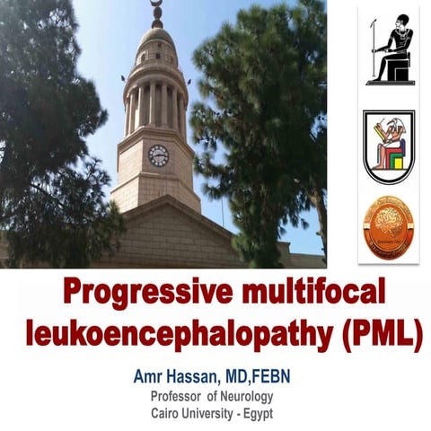 Progressive multifocal leukoencephalopathy (PML)