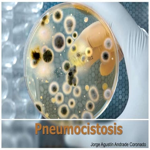 Pneumocistosis