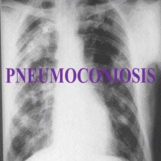 Austin Journal of Lung Cancer Resea...