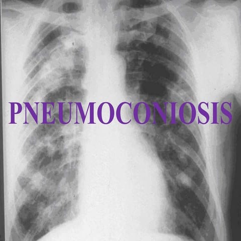 Austin Journal of Lung Cancer Research