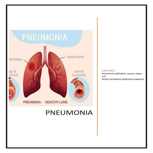 pneumonia-180606035507.pdf