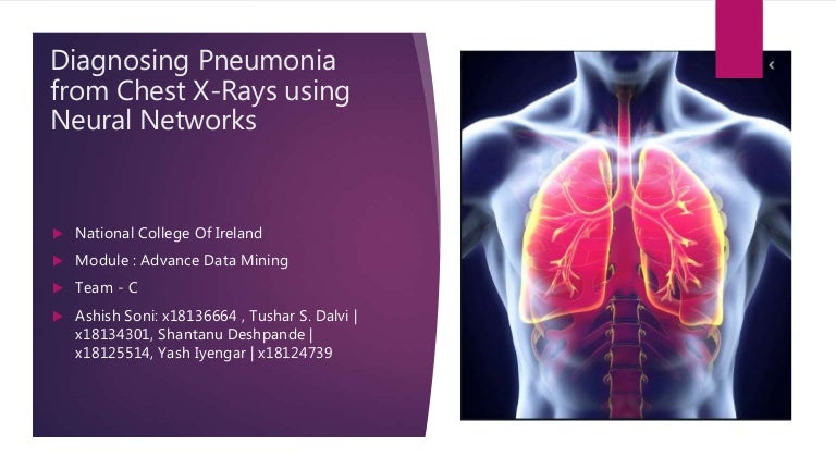 Pneumonia detection using cnn