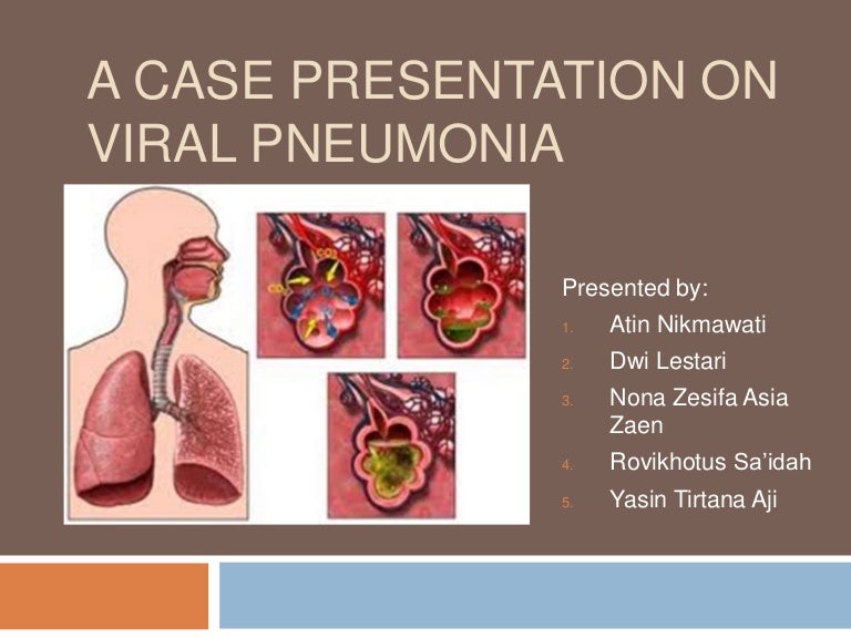 Diagnostic Test Viral Pneumonia study case