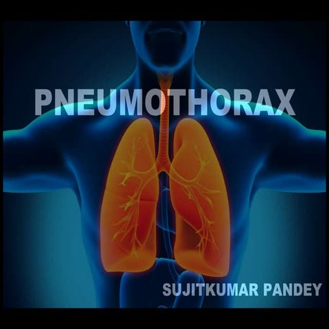 Pneumothorax PPT
