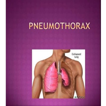 PNEUMOTHORAX_075811.pptx