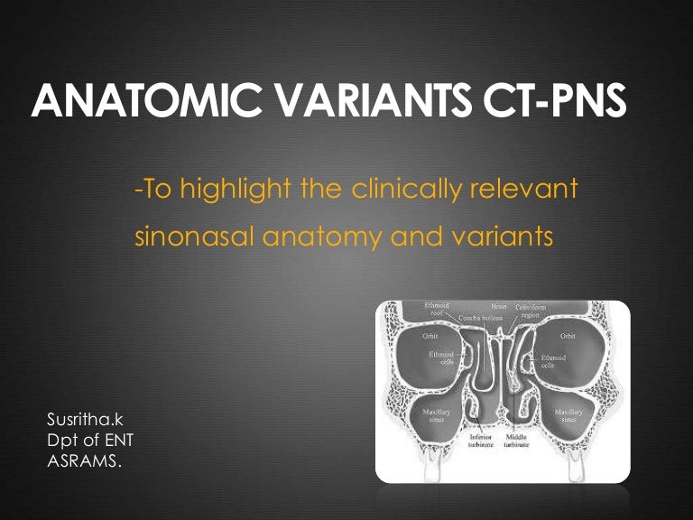 ANATOMICAL VARIANTS OF CT PNS
