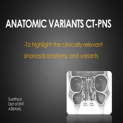 ANATOMICAL VARIANTS OF CT PNS