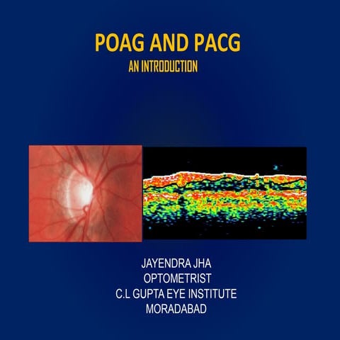 POAG AND PACG
