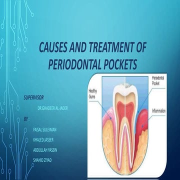 dental pocket