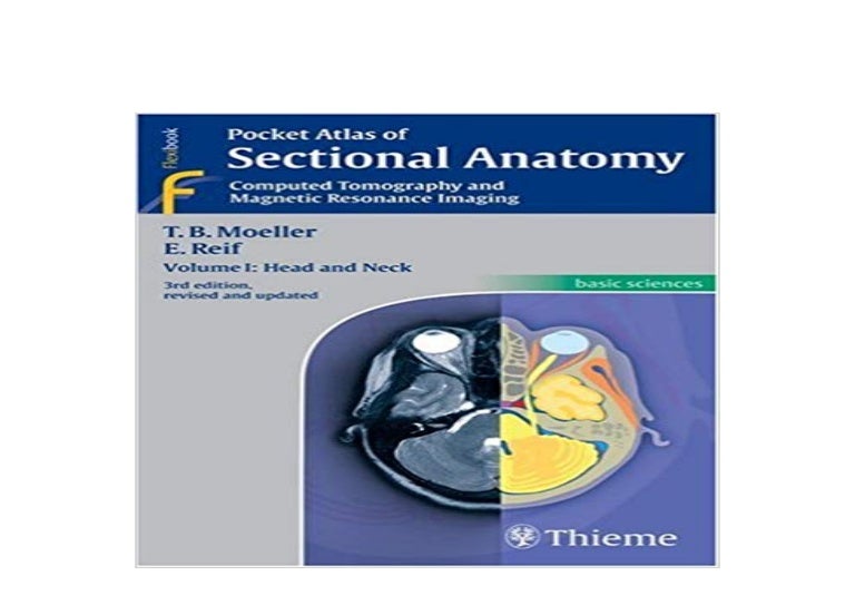 [download]_p.d.f$@@ Pocket Atlas of Sectional Anatomy Computed Tomogr…