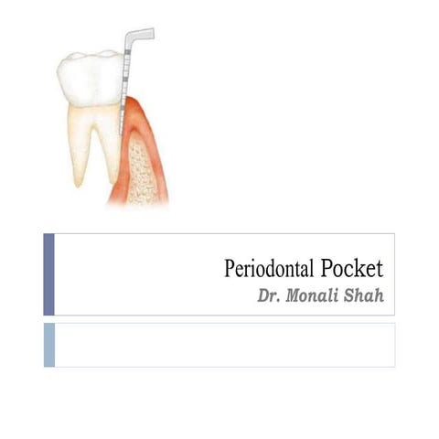 Periodontal Pocket