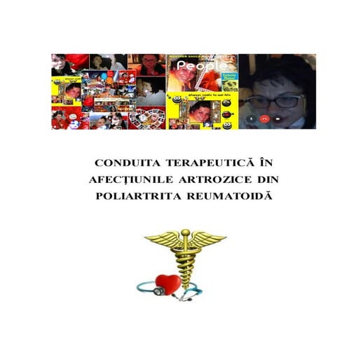 Poliartrita reumatoida