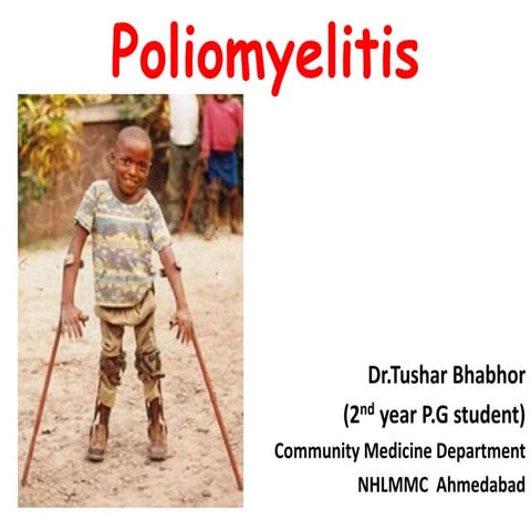 Polio | PPTX
