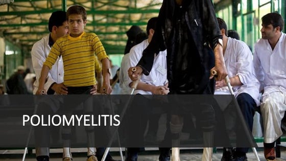 Polio | PPT